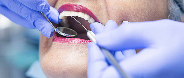 Best Emergency Tooth Extraction in Shepherd, MI