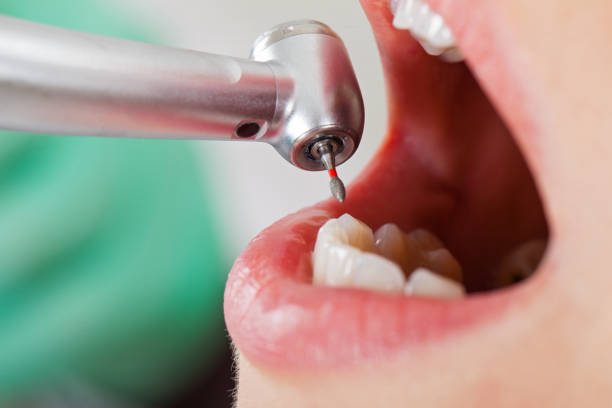 Best Same-Day Emergency Dental Services in Shepherd, MI